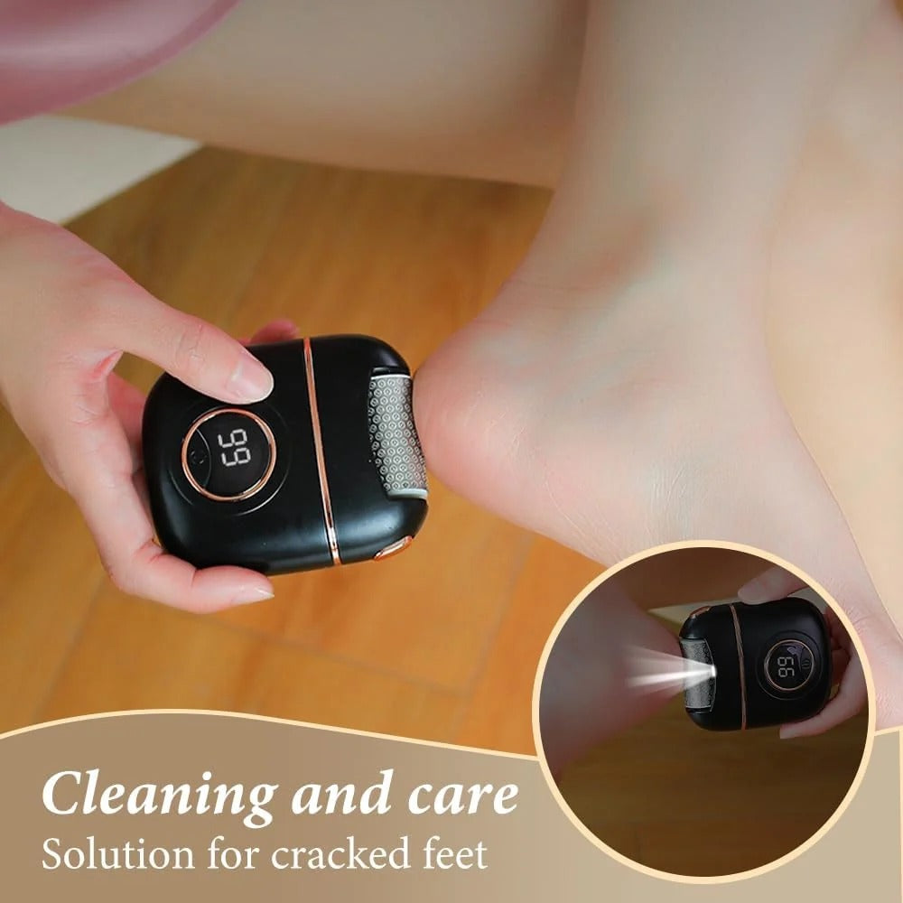 Electric Foot Callus Remover