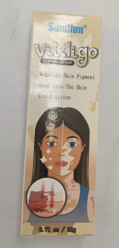 Sumifun - Vitiligo Removal Cream