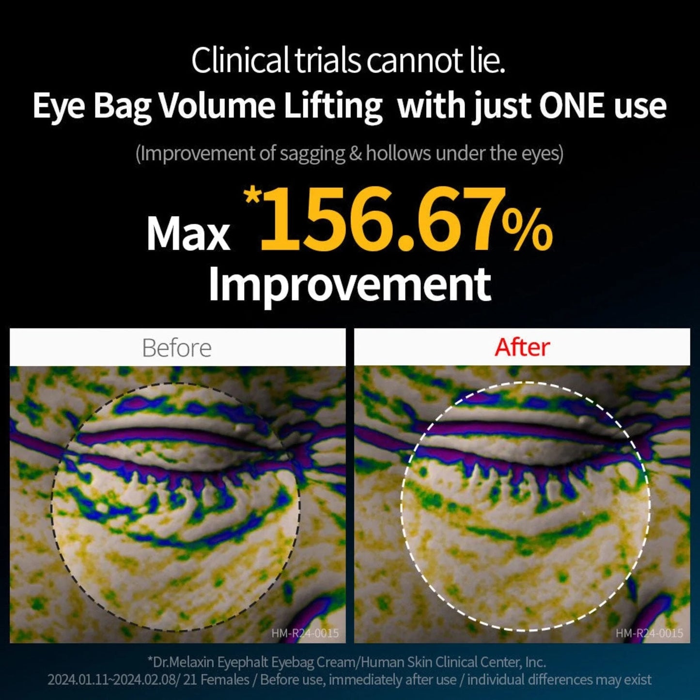 Dr Melaxin - Eyephalt Eyecream